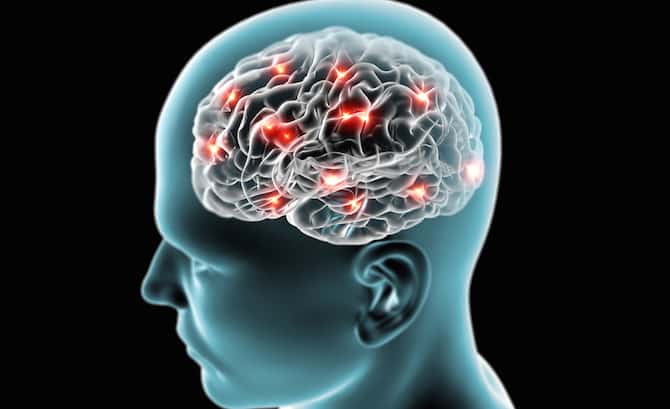 brain graphic
